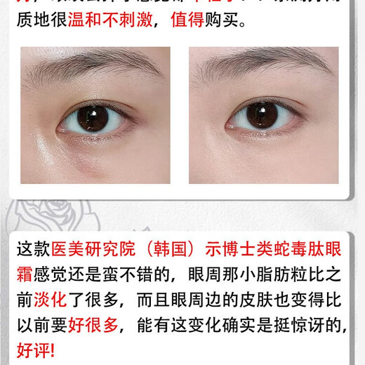 示博士【香港大药房】蛇毒肽去眼袋眼霜黑眼圈脂肪粒去细纹紧致抗皱保湿 3瓶【中度眼袋适用】