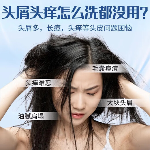 南京同仁堂二硫化硒洗发水去屑止痒滋养头皮控油蓬松毛囊清洁头屑止痒男女士 二硫化硒洗发水1瓶300ml