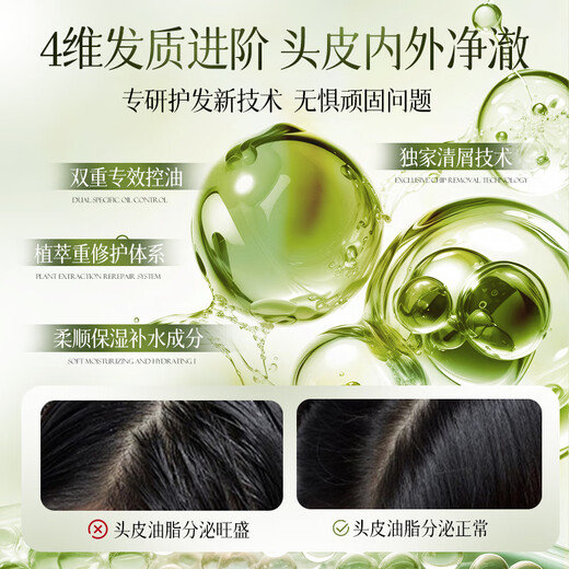 Viters Shampoo Anti-Dandruff Anti-Od-Kontrollöl langlebig flauschige Männer und Frauen Shampoo Goldliste Nr. 1 Shampoo Rest Shampoo