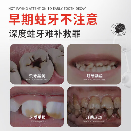 Colongon英国进口宝宝儿童牙膏3-6-12岁专效防蛀固齿含氟牙膏牙龈护理50g