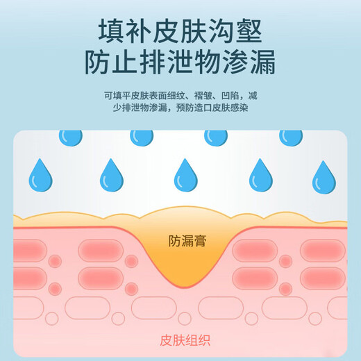 
Tongtong belongs to me stoma leakage prevention cream. Medical quality, alcohol-free stoma care products. 12050/183910 flat substitute. 5012 stoma leakage prevention cream. 60g