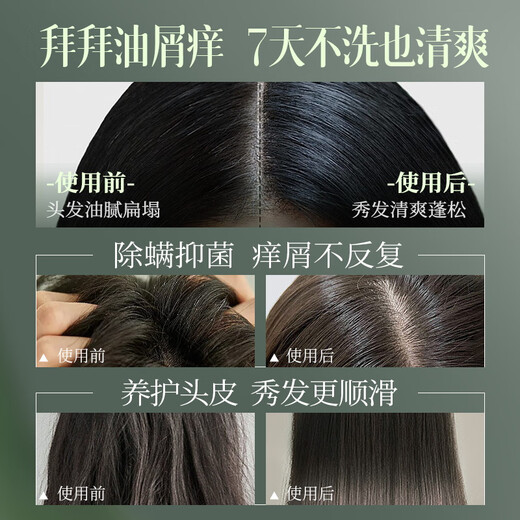 儒意（RUYI）氨基酸洗发水去屑止痒控油持久蓬松 洗头膏露男女士金榜第1名留香