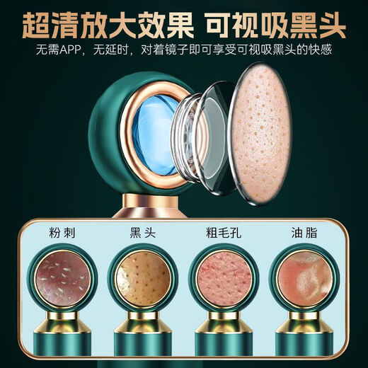 KONKA blackhead suction visual facial beauty export instrument household facial acne pore cleaning artifact 1499 tail goods machine quality home appliances 3-speed mode control upgrade fully equipped with movement visible deep cleaning 3 silicone suction tips