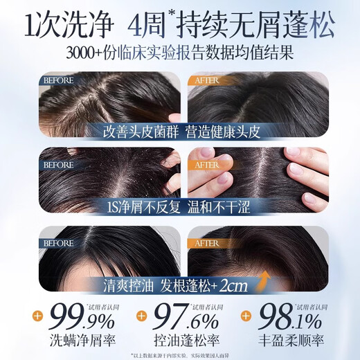 dyey Sinopharm Health Selenium Disulfide Oil Control Anti-dandruff Shampoo Relieve Itchy Flush Hair Follicles Cleaning Mite Removal Washing Cream