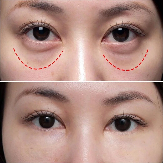 九叶草眼霜保湿补水提拉紧致抗眼纹眼部男女士精华30g
