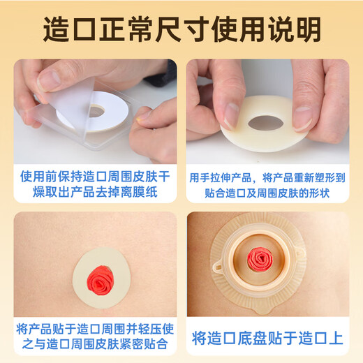 Krankenschwester Klassenkameradstoma-Lecksoacher Ring 12035 gleiche Plastikfleck-Ring-Chassis-Leckdosen-Patch-Dichtung elastischer Kleber Stoma Pflegeversorgung [10 Stück/Box] 2,5 mm12035