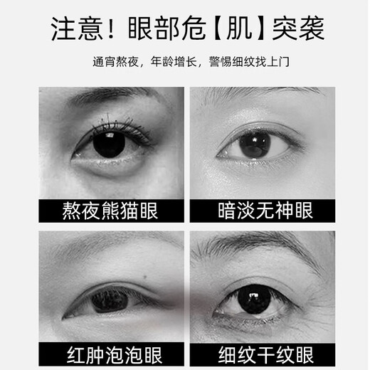 眼袋去除神器眼袋严重问题中老年男女士毒蛇肽眼霜黑眼圈严重眼袋 1盒【轻度眼袋适用】