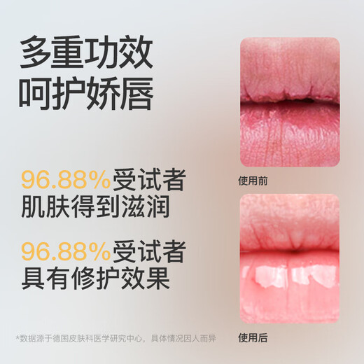 Sakose Vaseline Repair Lip Balm 2 5,6 g Herbst- und Winter-Anti-Drogen- und Risse, feuchtigkeitsspenstige Lippenmaske feuchtigkeitsspendende Lippenmuster