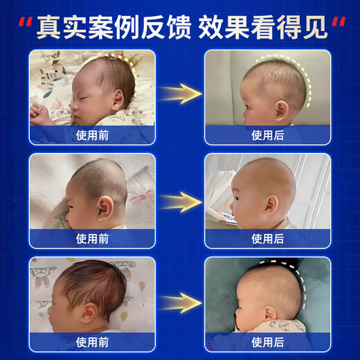 Lebender Stein (lebende Steine) Festes Kissen Baby 0-6 Monate Schlafroundkopf Baby Kissen 0-1 Jahre alte korrigierte mitochondriale Neugeborene Kissen Weiß Blau [0-6 Monate] 7A Antibakteriell + kühles und warmes doppelseitiges Baby 0-2 Jahre altes Maschin
