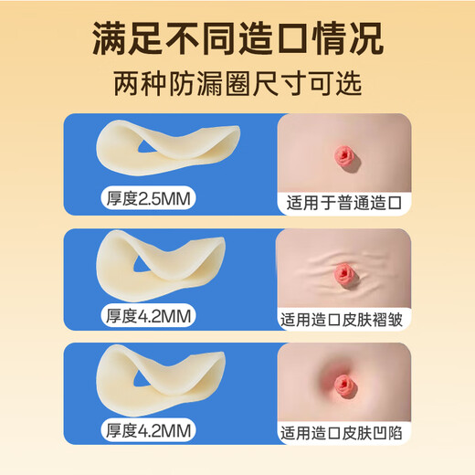 Krankenschwester Klassenkameradstoma-Lecksoacher Ring 12035 gleiche Plastikfleck-Ring-Chassis-Leckdosen-Patch-Dichtung elastischer Kleber Stoma Pflegeversorgung [10 Stück/Box] 2,5 mm12035