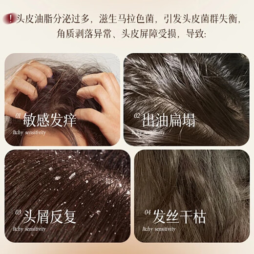 NULAD [Imported in Switzerland] Selenium disulfide anti-dandruff shampoo anti-itchi removal mite control oil control shampoo for men and women [Imported in Switzerland] Selenium disulfide shampoo 1 bottle