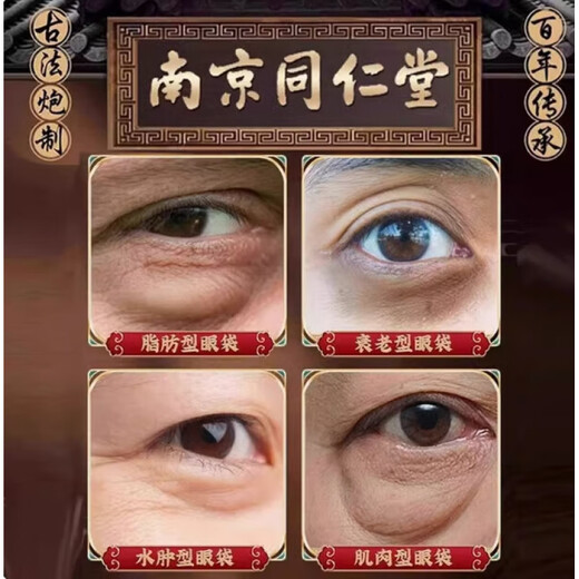 
Pure eye bag removal tool for men's special anti-wrinkle fine lines fading and lifting dark circles tightening eye cream 100g heavy cycle package