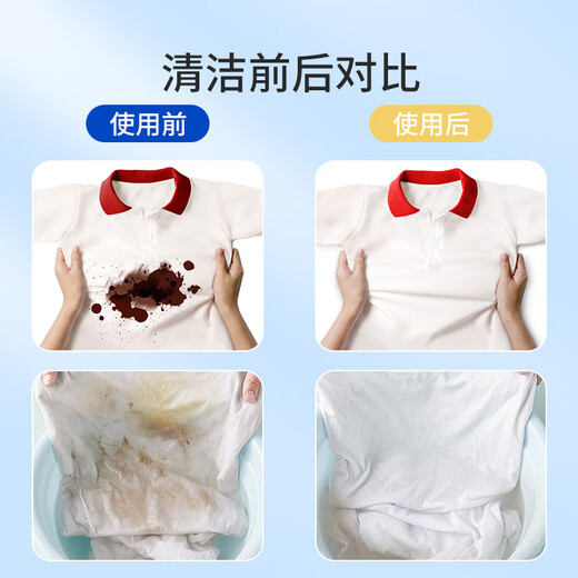 MIOLTTA Oil-stained Clothes Cleaner, Stubborn Stains Cleaner, White Clothes Powerful Oil and Contamination King Oil Stain Remover 250ml 1 Bottle