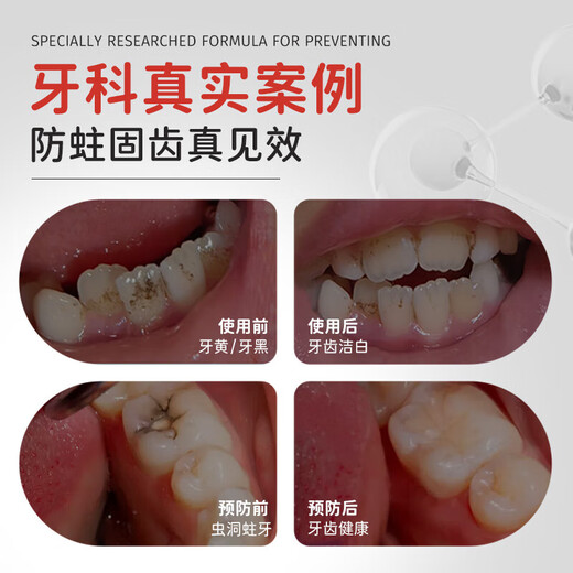 Colongon英国进口宝宝儿童牙膏3-6-12岁专效防蛀固齿含氟牙膏牙龈护理50g