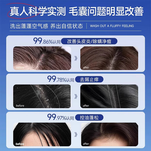 dyey Sinopharm Health Selenium Disulfide Oil Control Anti-dandruff Shampoo Relieve Itchy Flush Hair Follicles Cleaning Mite Removal Washing Cream