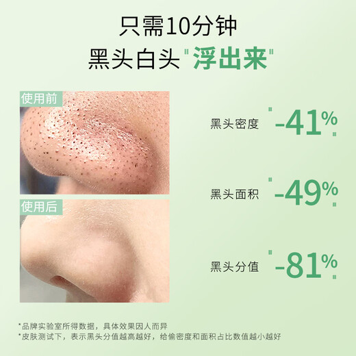 
Bisutang blackhead and nose patch closed mouth shrink pores deep cleaning tool export liquid for men and women's suit nose tips 2-part blackhead and nose patch film/1 box official flagship store genuine guarantee