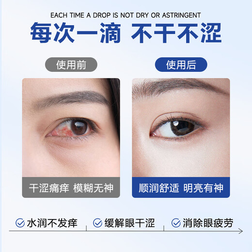 
Shigaoka Japanese Lutein Eye Drops Eye Drops Relieve Eye Fatigue Dry Vision Blunder Stay up late to play with mobile phone floaters