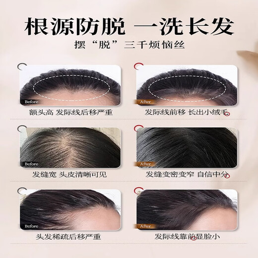 
Dyey Orchidaceae Leaf Herbal Plant Shampoo Oil Control Anti-dandruff Chinese Medicine Prevent Hair Developing Soft Cleansing Hair Care Shampoo