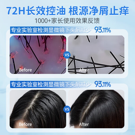 Masata Singapore imported children's shampoo oil control, dandruff and anti-itching shampoo for men and women over 3 years old 500g