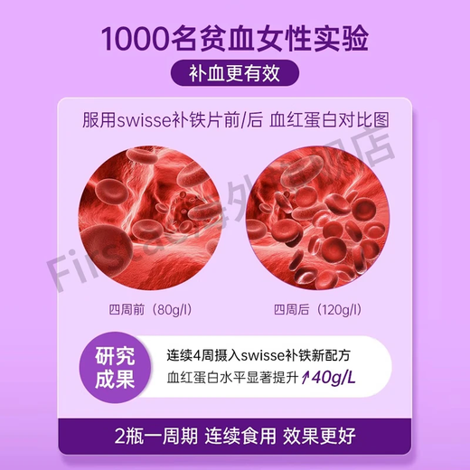 Swisse probiotics for pregnant women constipation to regulate the gastrointestinal and intestines to help digestion, laxatives and bloating during pregnancy nutrition during breastfeeding [regulating the gastrointestinal and inconstipation] 30 probiotics for pregnant women