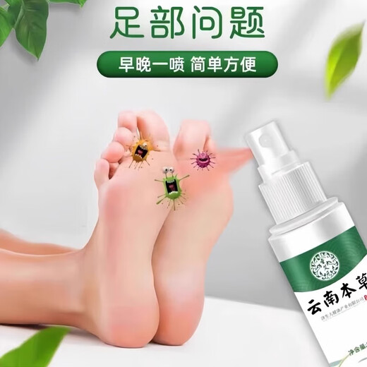 Yunnan Materia Medica Genuine Foot Antibacterial Spray Foot Antibacterial Cream Sweat Foot Odor Water Air Spray SN9911 999 Fluid/Effect [Minority/Athlete]
