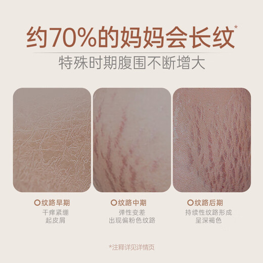 袋鼠妈妈妊娠油准孕妇可用改善纹路护肤品舒缓妊辰纹橄榄油精华身体按摩油 【热销爆款】舒纹橄榄油96ml