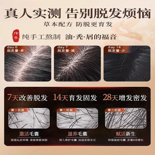 
Dyey Orchidaceae Leaf Herbal Plant Shampoo Oil Control Anti-dandruff Chinese Medicine Prevent Hair Developing Soft Cleansing Hair Care Shampoo