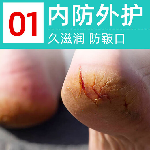 Doctor's Cracked Foot Cream 50g White Vaseline Hand and Foot Anti-Crack Cream for Cracked Feet, Cracked Hands, Cracked Heels, Cracked and Cracked Heels