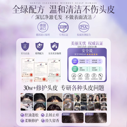 
Chuman Shampoo Men and Women's Anti-dandruff Anti-Itch Control Oil Long-lasting Fluffy Fragrant Shampoo Dew Amino Acid Shower Gel Set [Washing Set] Youlan Shampoo + Shower Gel Fat Silicone-free Oil Donglai Shampoo Gold List TOP