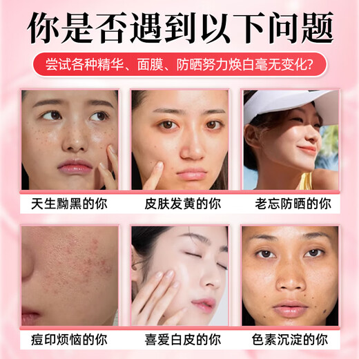 Peking Tongrentang Vitamin C Vitamin E Niacinamid Kollagentabletten Männer und Frauen Multivitamin Vcve Niacin -Kau -Tabletten Vcve Niacinamid [3 Flaschen]