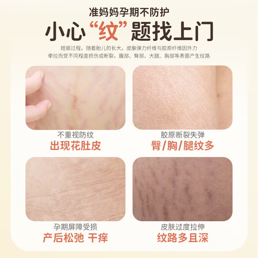 Masata新加坡进口妊娠油孕妇专用预防淡化纹干痒修复妊娠纹橄榄油120ml