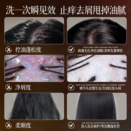 Moihanr Deutsches Shampoo für Männer und Frauen, Anti-Dandruff, juckende und ölgesteuerte flauschige, lang anhaltende Duft, erfrischende, mildeentfernung und Reinigung der Haarreinigungssahne