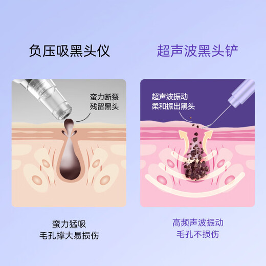 Small sago blackhead removal instrument, ultrasonic peeling machine, beauty instrument, household facial blackhead shovel, pore cleaning and suction, Fantasy Purple
