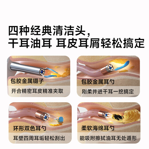bebird可视挖耳勺带镊子蜂鸟可夹蛇形掏耳勺可视掏耳朵神器套装粉金色