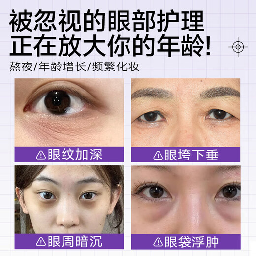 Naixi Japanese Eye Mask Eye Bag Lifting, Firming, Anti-Wrinkle, Diminishing Fine Lines and Dark Circles Remover, Men's Serious Special for Women