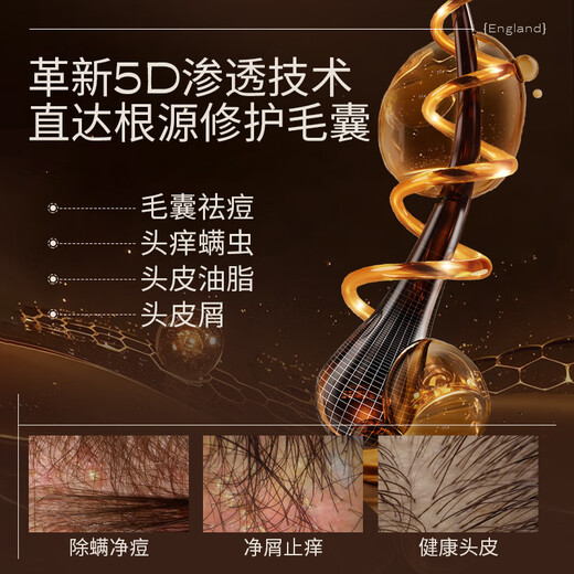 INSRE英国进口毛囊清洁洗发水氨基酸除螨止痒去屑控油蓬松洗发露男女士