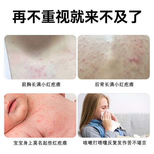 Renhe mite removal spray for home bed no-wash, sun-free, antibacterial baby mite spray supplies, pet quilt universal removal, mite removal and fragrance 1 bottle, single bottle is more expensive, recommended to buy a set