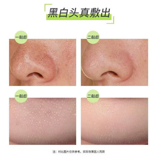 CNP T-Zone Care Remove Blackheads, Tighten Pores, Refresh Nose Mask, Sample 20 Pack