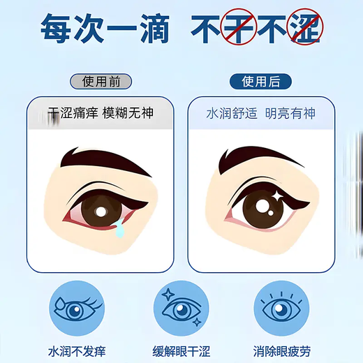Lutein Augenschutz Spray Tokio Yingzi Eye Müdigkeit beruhigt Artefakt beruhigt Trockenheit und Waschaugen. Lutein Augenschutz Spray * 1 Flasche