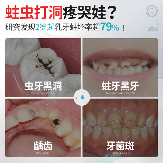 Masata新加坡进口儿童牙膏0-3-6-12岁专效防蛀固齿宝宝含氟牙膏龋齿50g
