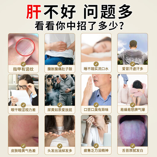 扁神医修合牌葛根黄芪片护肝片脂肪肝肝脏排毒养肝护肝片喝酒熬夜男女士 扁神医修合牌葛根黄芪片3盒装【周期保障】 官方店旗舰正品