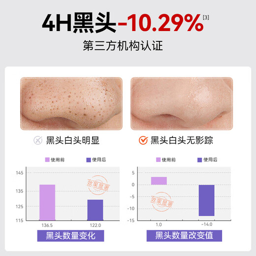 Bei'an personally develops a deep cleaning tool for BRLAB blackhead export liquid oil control and removes blackhead water and removes acne and shrinks pores