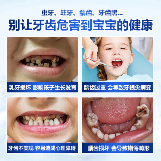 BEAI Children's Toothpaste 3-12 years old, fluorine-containing anti-causing Ol Fluoride Children's Toothpaste Gingival Care Stain Removal and Fresh Combination