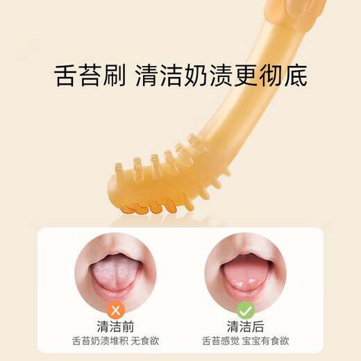 婴儿牙刷0-1岁半宝宝口腔乳牙清洁棒新生儿舌苔清洁器硅胶 乳牙刷3只装