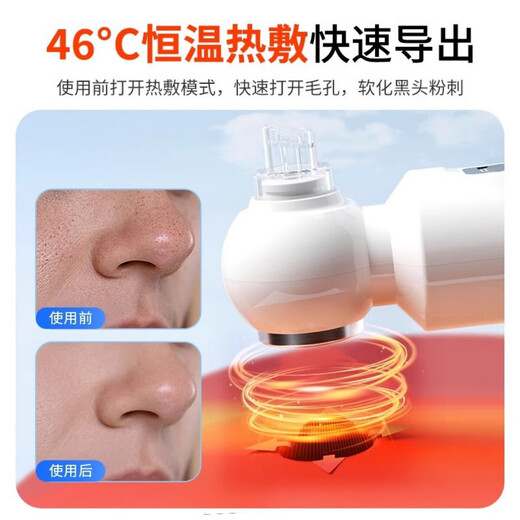 HYUNDAI small bubble blackhead absorber, electric blackhead absorber, beauty instrument, household facial pore cleaning aspirator, Christmas gift for boys and girls, gift box hot compress, sewage separation + four types of adjustment + constant temperature hot compress Chinese Valentine's Day
