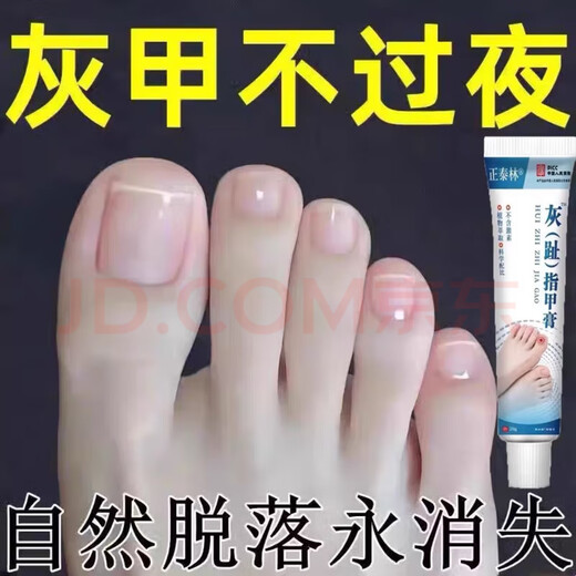Empty, bad, thickened and yellowed herbal armor, severe onychomycosis, antiseptic liquid, brightening nail antibacterial ointment, 999+, severe and powerful