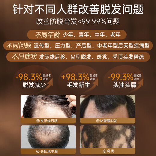 RUYI Anti Hair Loss Hair Growth Essence 100ml Hair Firming Hair Growth Agent Activates Hair Follicles to Increase Hair Loss and Thick Hair Growth Essence