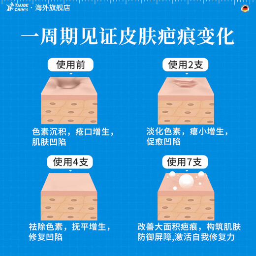 TaubeChing German original scar removal cream for scar removal and repair, medical silicone proliferative bumps to remove pimples, 4 boxes of periodic packaging, burns and scalds/surgery/hyperplastic scars