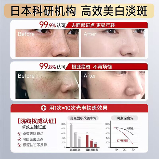 Dr. Jiao Japan 377 freckle cream whitening and lightening aged brown freckles melanin arbutin cream to remove sunburn for men and women