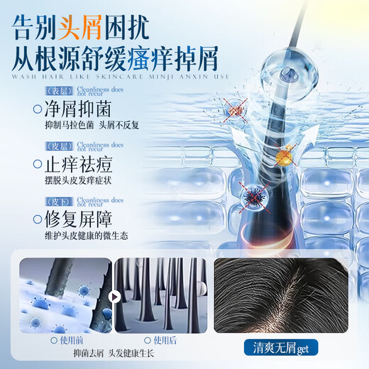 Vetes Shampoo Oil Control Anti-dandruff Anti-Itchy Fluffy Men and Women Long-lasting Fragrance No Silicone Oil Cleansing Shampoo Shampoo [JD Gold List] Oil Control Anti-dandruff Top List